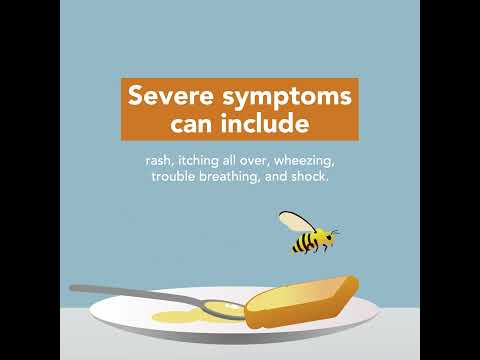 Bee Stings: Symptoms & Treatment | Merck Manual Consumer Version